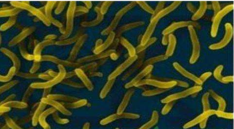 微生物菌劑好？好在哪里您知道嗎？